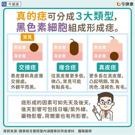 痣為什麼會長毛|是痣？還是皮膚癌？皮膚科醫師教你揪出「假的痣」，。